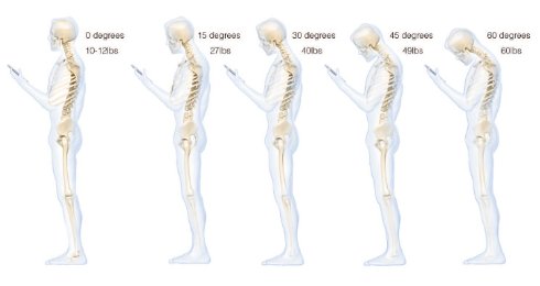 Смартфоны вредны для позвоночника