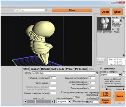 Пять вещей, которые можно распечатать на 3D-принтере. Часть №2: как самому напечатать продолговатый мозг - 6