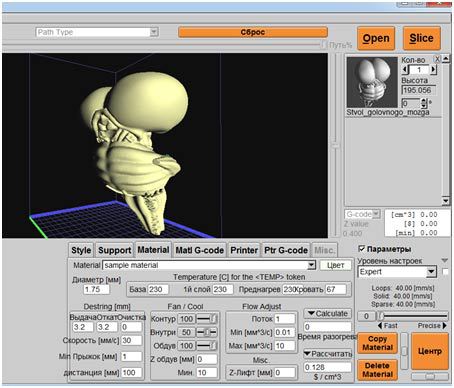 Пять вещей, которые можно распечатать на 3D-принтере. Часть №2: как самому напечатать продолговатый мозг - 8