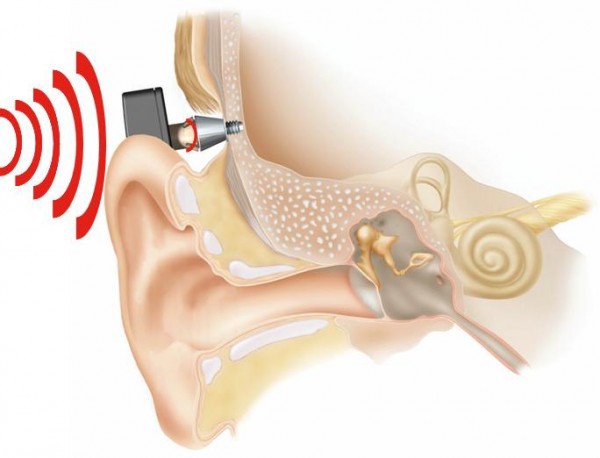 Aftershokz и другие устройства с костной проводимостью звука - 3