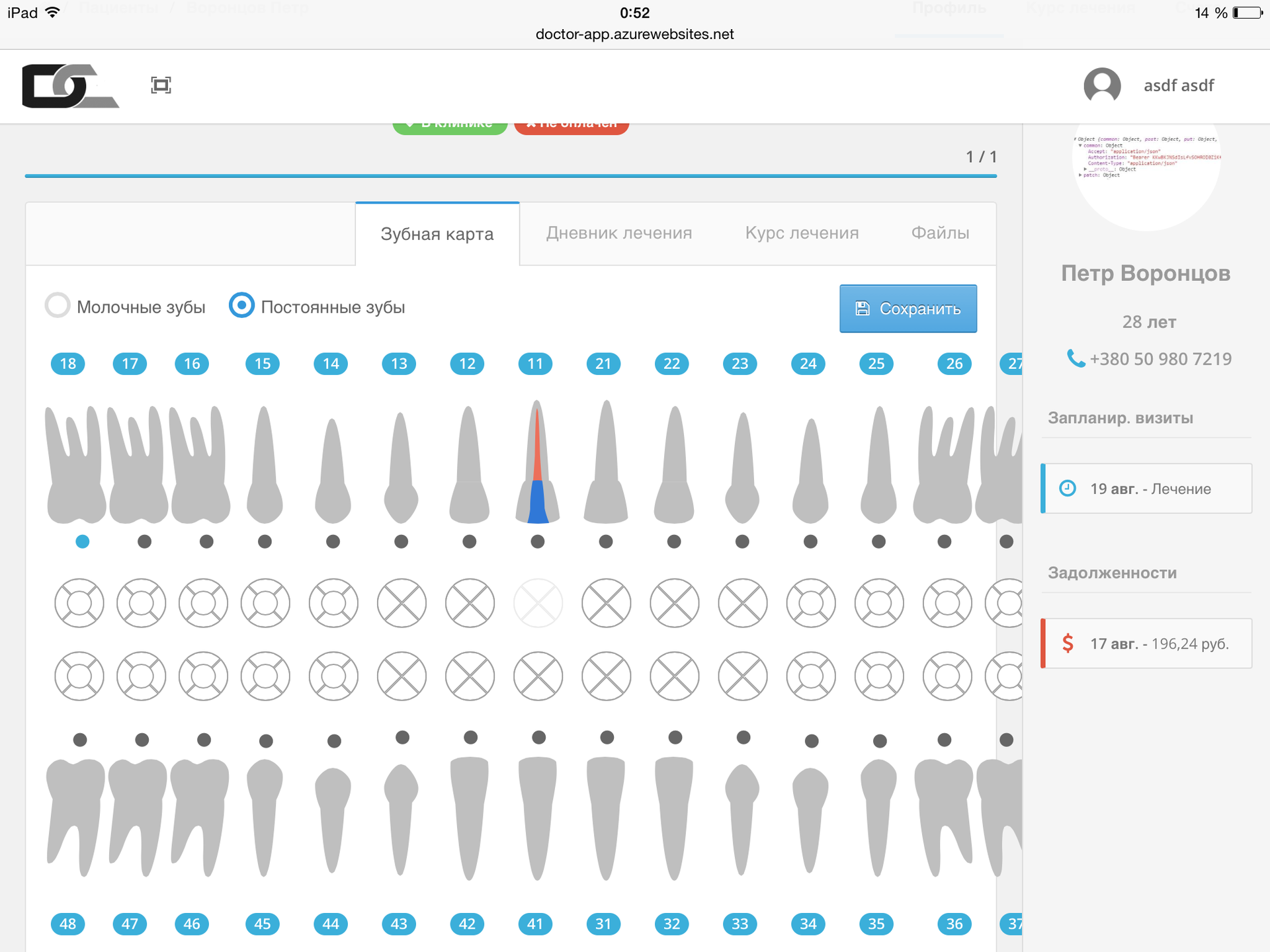 Dental cloud. Дентал Клауд. Зубная карта веб. Dentist+ Интерфейс.