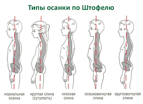 Lumo Lift — электронный корректор осанки для офиса - 2