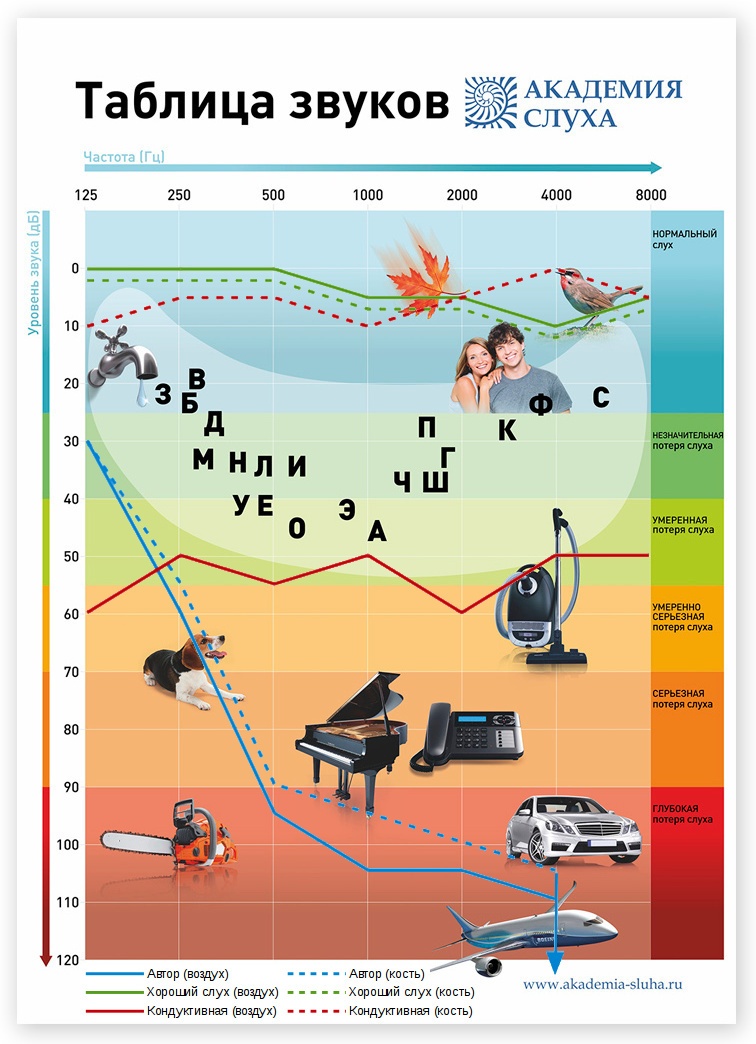 Нормальный слух. Диаграмма потеря слуха. Аудиометрия частоты звука. Таблица потери слуха. Аудиограмма слуха таблица.