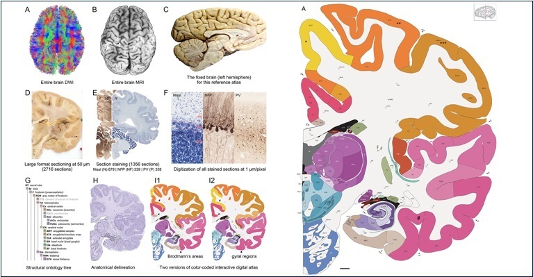 Впервые составлен полный атлас человеческого мозга с клеточным разрешением 1 мкм-пиксель - 2