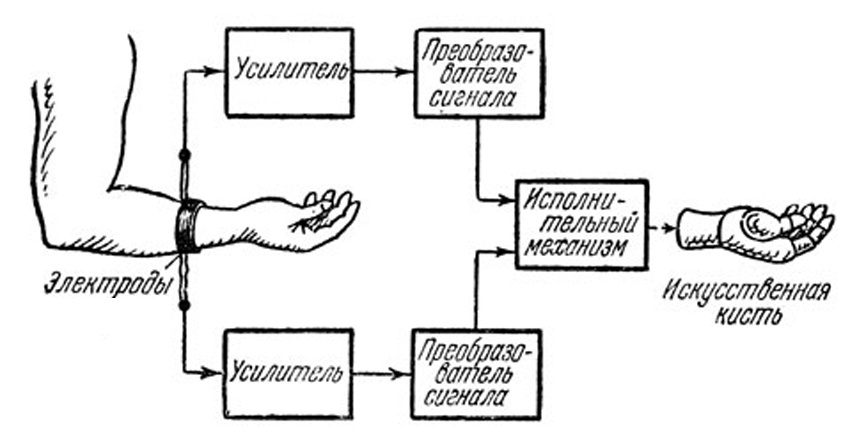 Схема бионического протеза