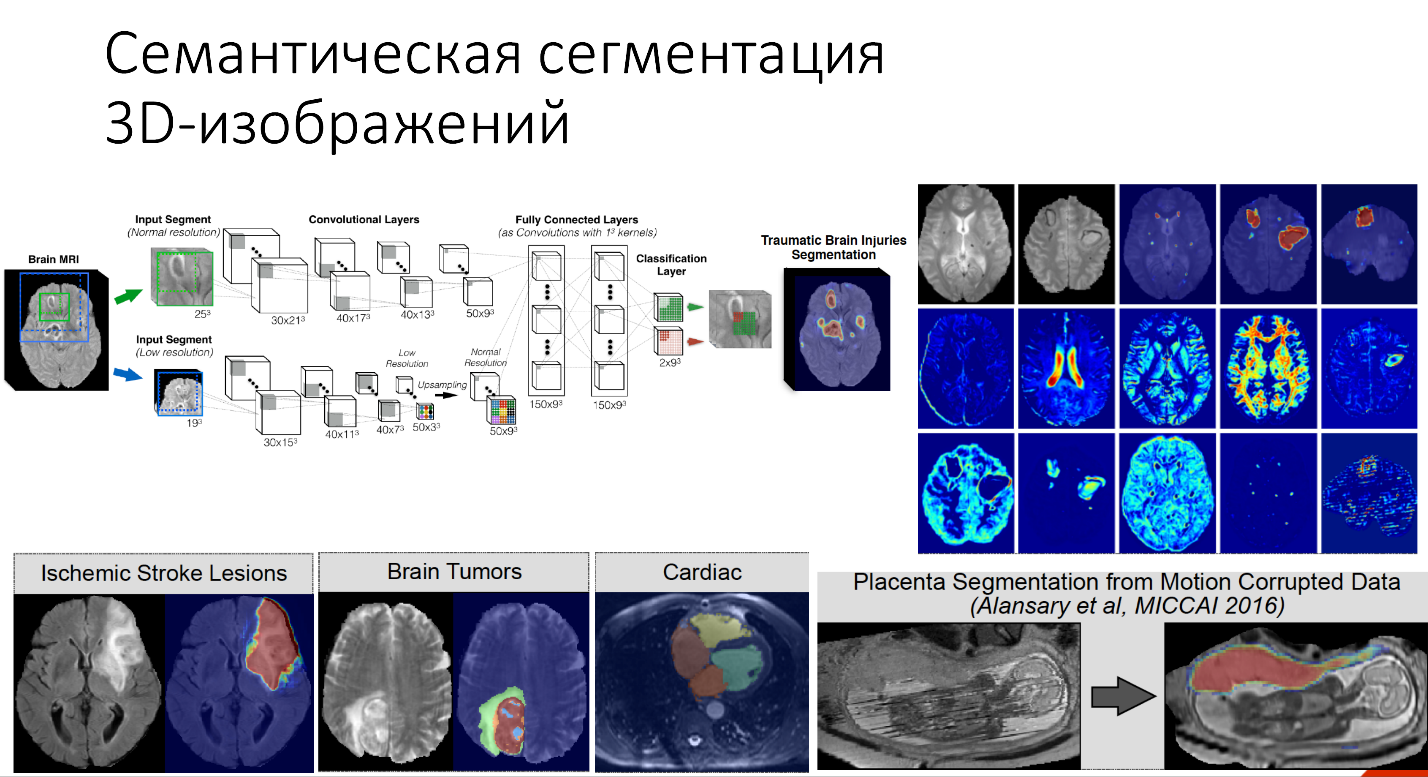 Нейросети в медицине