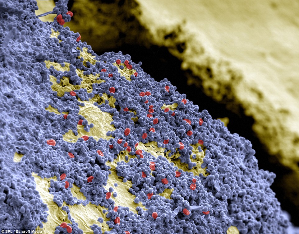 Streptococcus mutans