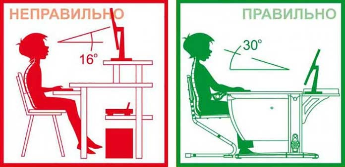 Сколиоз vs Школа: что следует помнить про сколиоз - 1