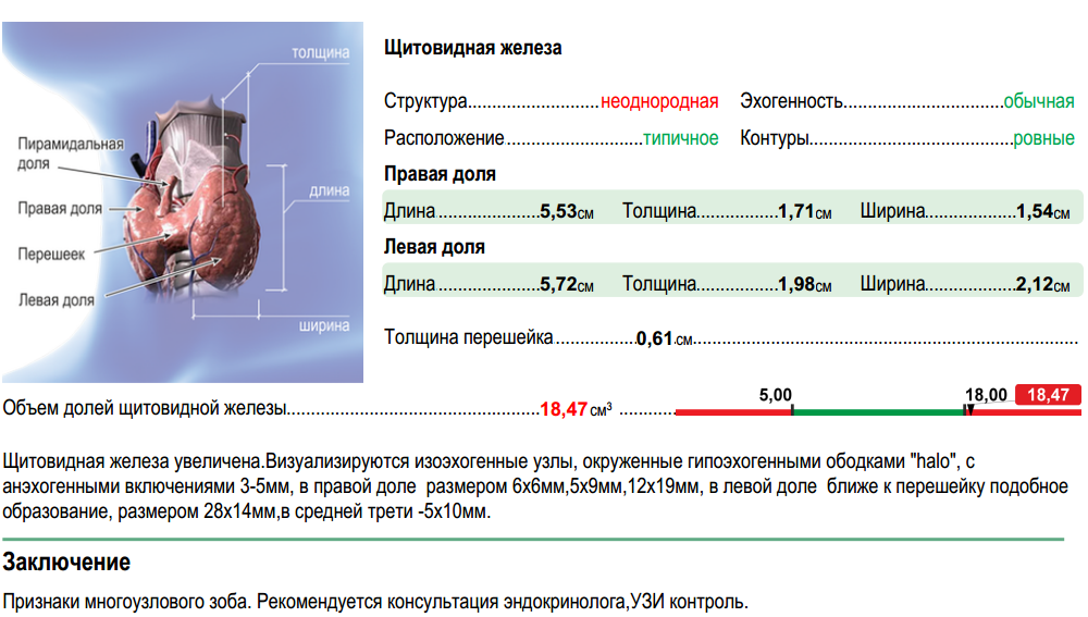 Щитовидная железа узлы размеры норма