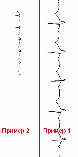 Как звучит сердцебиение: перевод бумажной кардиограммы в WAV-формат - 5