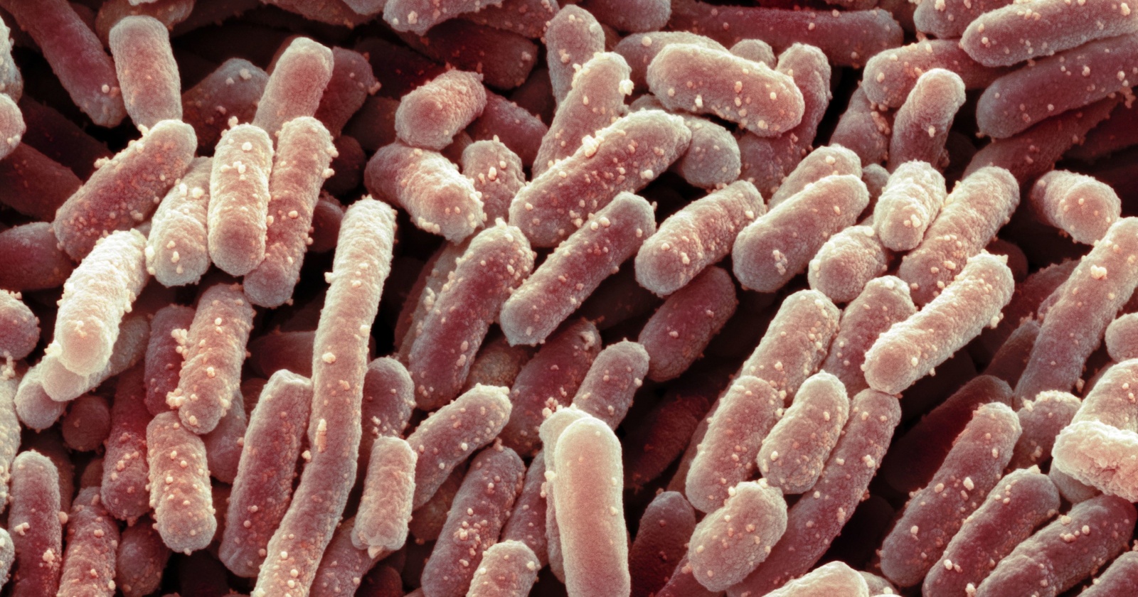 Болгарская палочка. Болгарская палочка Lactobacillus bulgaricus. Lactobacillus delbrueckii subsp. Bulgaricus. Lactobacillus bulgaricus под микроскопом. Lactobacillus delbrueckii subsp. Bulgaricus под микроскопом.