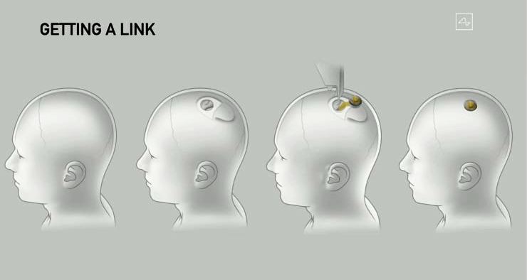 Илон Маск продемонстрировал Neuralink - 4