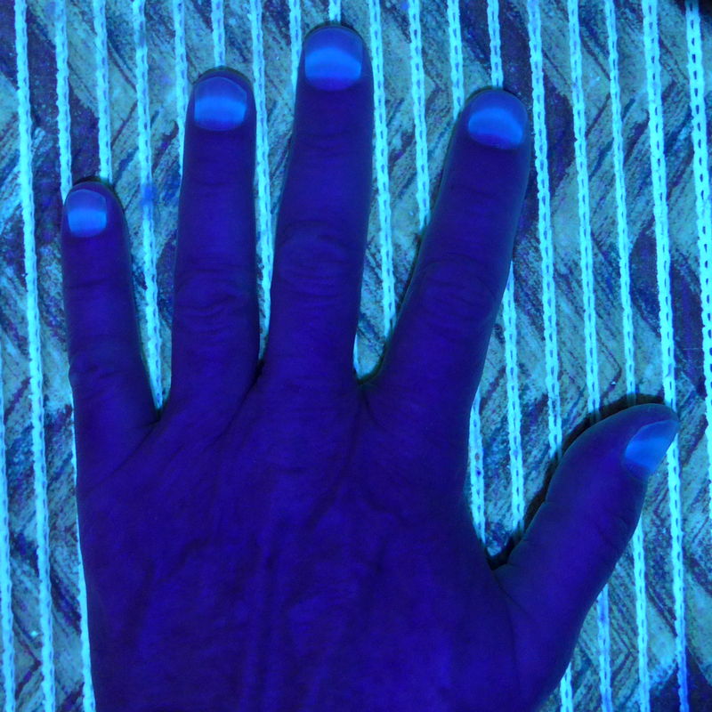 Грибок ногтей под лампой вуда фото