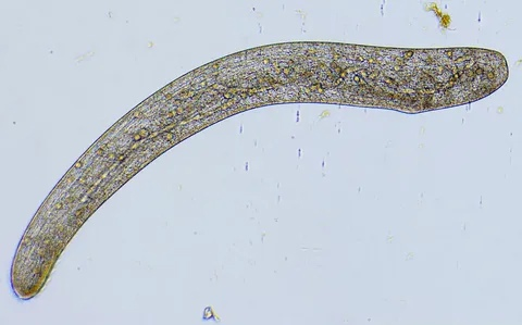 Spirostomum ambiguum (Источник: https://en.wikipedia.org/wiki/Spirostomum)