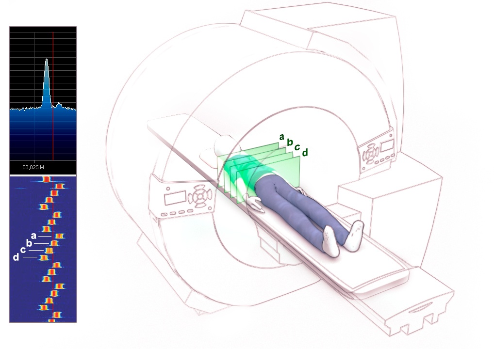 Разные частоты на радиоспектре соответствуют пространственным срезам, которые в данный момент сканируются в МРТ. При этом последовательности сигналов у стандартных протоколов для головы или спины отличаются, а значит можно путём анализа определить какую часть тела сканируют и с какими параметрами. Здесь показан упрощённый вариант, на самом деле срезов в этой последовательности больше четырёх.