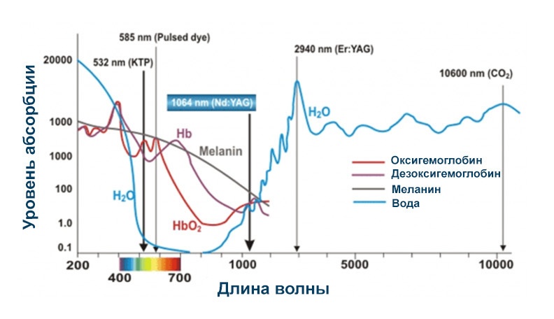 Про стоматологический лазер для зубов (быстро и чисто, но не работает) - 2