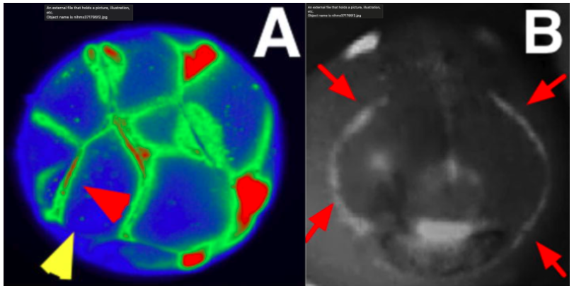 А: Используя красители, ученые обозначили электрические градиенты в эмбрионе лягушки всего в 16 клетках. B: Поля изопотенциальных клеток показывают области, которые предвещают выброс генов-регуляторов во время черепно-лицевого развития эмбриона лягушки.