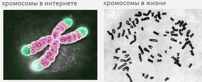 Хромосомы и их проблемы, изображение №2