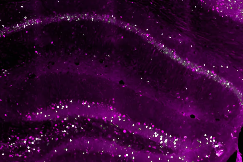 На этом поперечном сечении гиппокампа мыши, пурпурным цветом показаны рано зародившиеся нейроны, которые отвечают за создание долговременной копии памяти. Базельский университет, Биоцентр