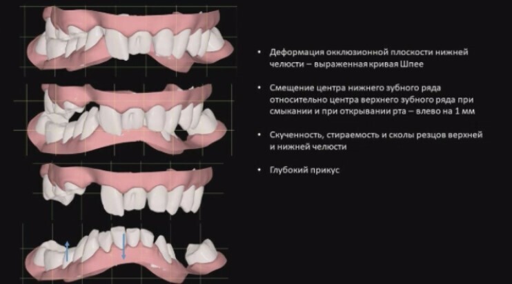 Клинчек помогает находить решения даже в таких сложных ситуациях.