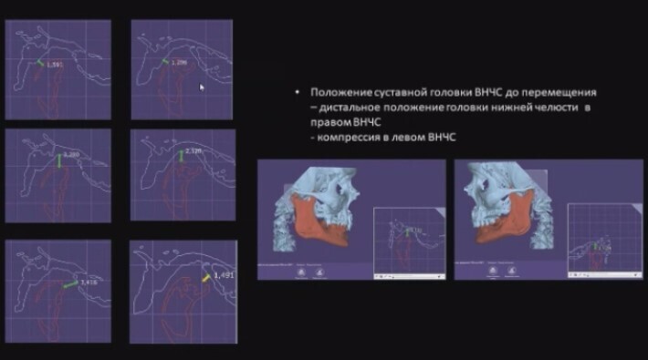 По КТ было непонятно, что делать, а по клинчеку - понятно.