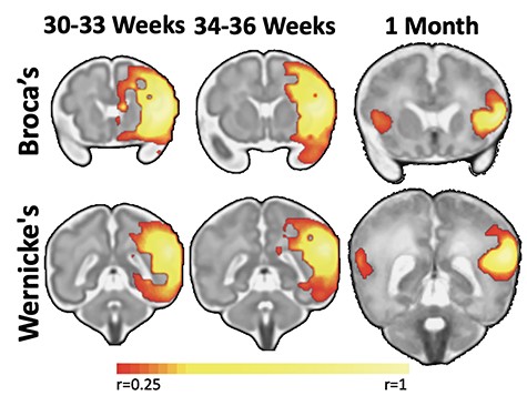 Развитие связей между центром Брока и областью Вернике в третьем триместре и в первый месяц жизни. Научная работа «Functional connectivity for the language network in the developing brain: 30 weeks of gestation to 30 months of age» [doi:10.1093/cercor/bhab415]