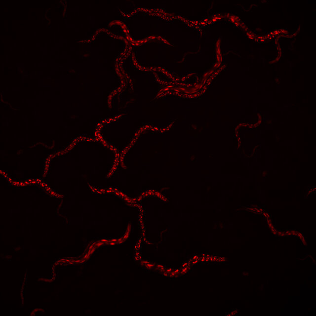  C. elegans движется под микроскопом; видны флуоресцентные белки внутри него.