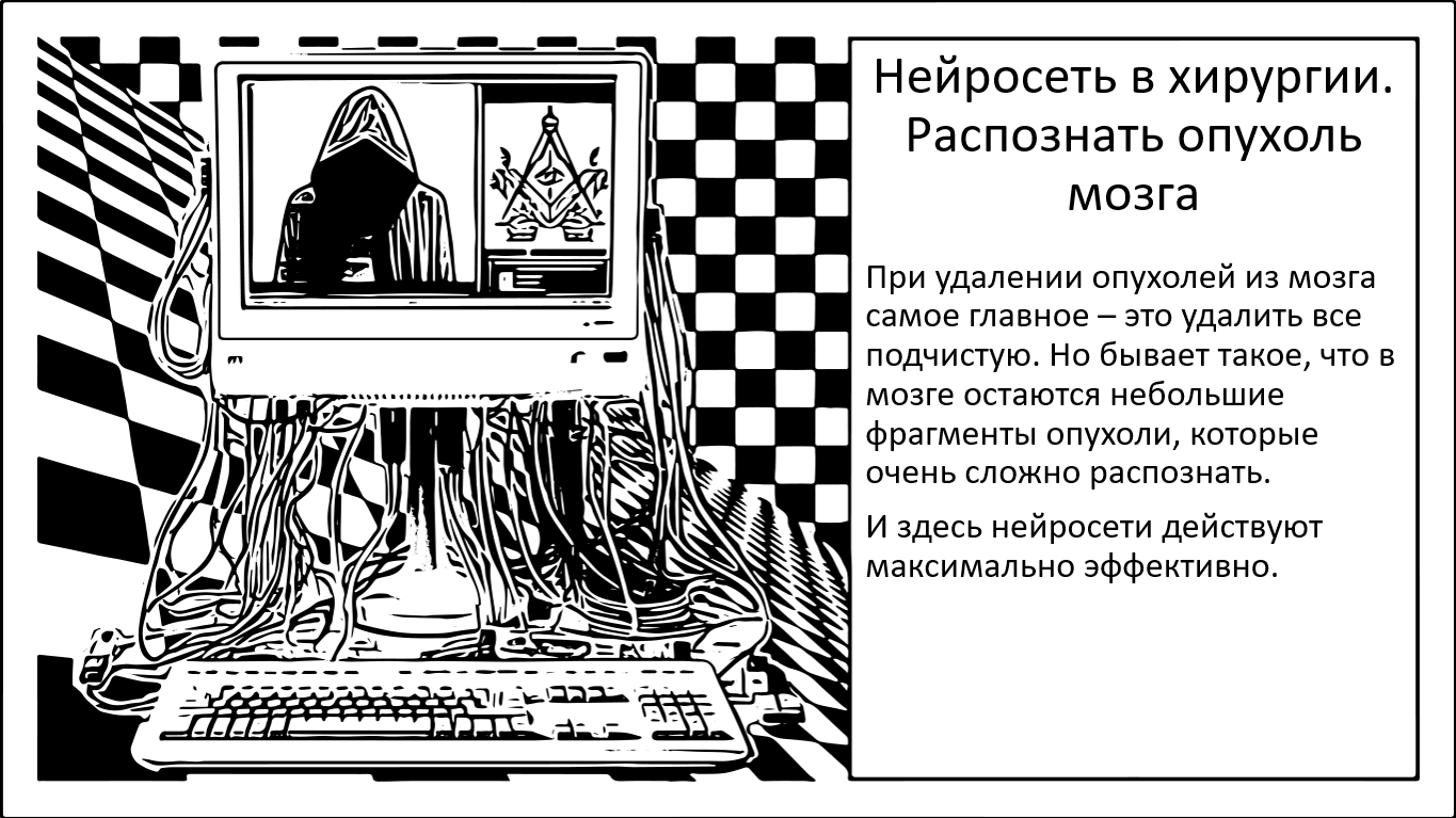 Нейросеть в хирургии. Распознать опухоль мозга за 10 секунд - 1