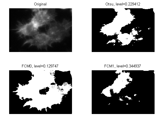 B c means. Thresholding Otsu.